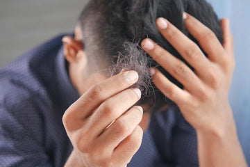 The Genetic Factors Behind Hair Loss What You Need to Know